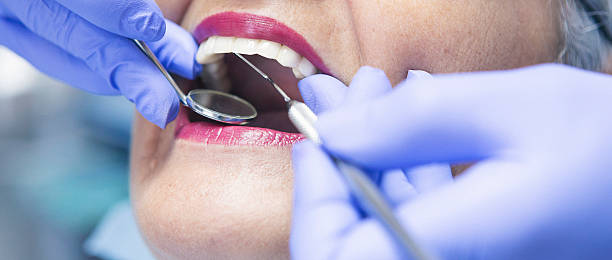 Best Emergency Treatment for Oral Infections in Riverse, ID